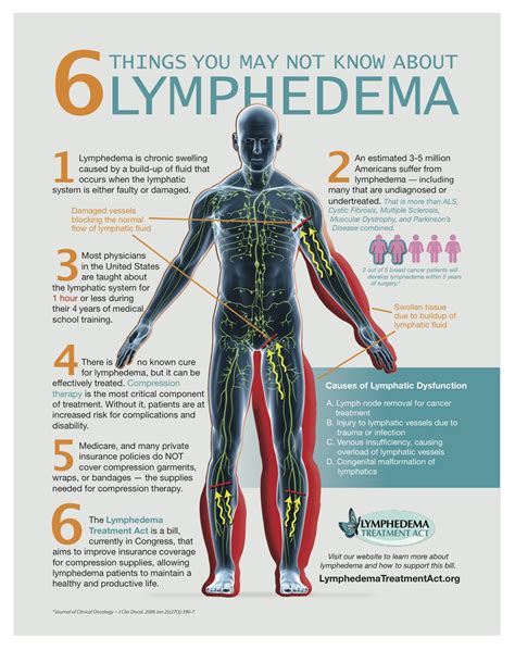 Lymphedema